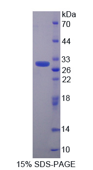 钙周期素结合蛋白(CACYBP)重组蛋白,Recombinant Calcyclin Binding Protein (CACYBP)