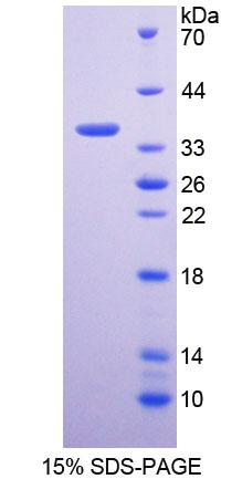 甘氨酸-N-甲基轉(zhuǎn)移酶(GNMT)重組蛋白,Recombinant Glycine-N-Methyltransferase (GNMT)