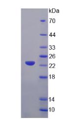 甘氨酰tRNA合成酶(GARS)重组蛋白,Recombinant Glycyl tRNA Synthetase (GARS)