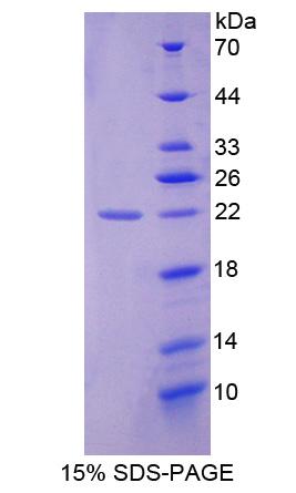 甘露糖-6-磷酸受体(M6PR)重组蛋白,Recombinant Mannose-6-Phosphate Receptor (M6PR)