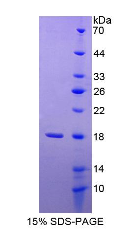 甘露糖苷酶α2B类成员1(MAN2B1)重组蛋白,Recombinant Mannosidase Alpha Class 2B Member 1 (MAN2B1)