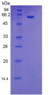 甘露糖结合蛋白(MBL)重组蛋白,Recombinant Mannose Binding Lectin (MBL)