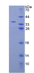 甘露糖结合凝集素1(LMAN1)重组蛋白,Recombinant Lectin, Mannose Binding 1 (LMAN1)