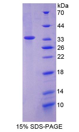 甘露糖結(jié)合凝集素2(LMAN2)重組蛋白,Recombinant Lectin, Mannose Binding 2 (LMAN2)