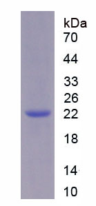 甘油磷酸肌醇锚定高密度脂蛋白结合蛋白1(GPIHBP1)重组蛋白,Recombinant Glycosylphosphatidylinositol Anchored High Density Lipoprotein Binding Protein 1 (GPIHBP1)