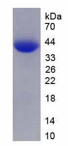 肝癌源性生长因子(HDGF)重组蛋白,Recombinant Hepatoma Derived Growth Factor (HDGF)