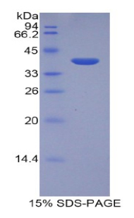 肝表達(dá)抗菌肽2(LEAP2)重組蛋白,Recombinant Liver Expressed Antimicrobial Peptide 2 (LEAP2)