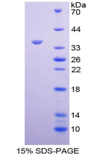 肝肠钙黏蛋白(CDH17)重组蛋白,Recombinant Cadherin 17 (CDH17)