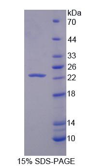 肝配蛋白A1(EFNA1)重组蛋白,Recombinant Ephrin A1 (EFNA1)