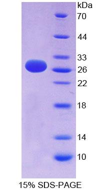 肝配蛋白A3(EFNA3)重组蛋白,Recombinant Ephrin A3 (EFNA3)