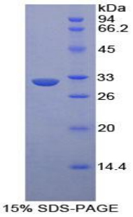 肝配蛋白A受体1(EPHA1)重组蛋白,Recombinant Ephrin Type A Receptor 1 (EPHA1)