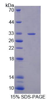 肝配蛋白A受体10(EPHA10)重组蛋白,Recombinant Ephrin Type A Receptor 10 (EPHA10)