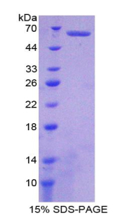 肝配蛋白B2(EFNB2)重组蛋白,Recombinant Ephrin B2 (EFNB2)