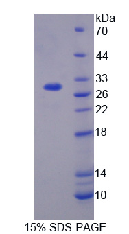 肝细胞生长因子(HGF)重组蛋白,Recombinant Hepatocyte Growth Factor (HGF)