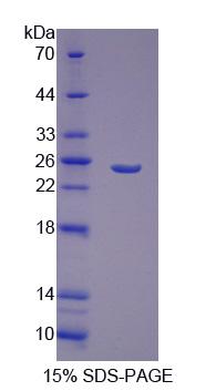 肝再生扩展生长因子(GFER)重组蛋白,Recombinant Growth Factor, Augmenter Of Liver Regeneration (GFER)