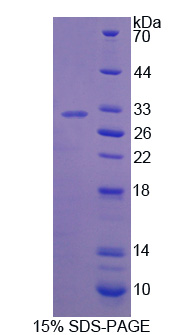 干擾素γ誘導(dǎo)蛋白30(IFI30)重組蛋白,Recombinant Interferon Gamma Inducible Protein 30 (IFI30)