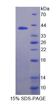 干扰素调节因子9(IRF9)重组蛋白,Recombinant Interferon Regulatory Factor 9 (IRF9)