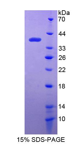 干扰素诱导蛋白35(IFI35)重组蛋白,Recombinant Interferon Inducible Protein 35 (IFI35)