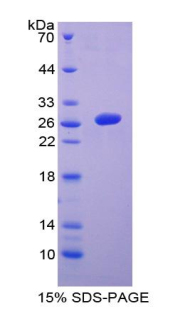 干细胞因子受体(SCFR)重组蛋白,Recombinant Stem Cell Factor Receptor (SCFR)