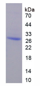 干燥综合征抗原B(SSB)重组蛋白,Recombinant Sjogren Syndrome Antigen B (SSB)