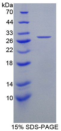 高密度脂蛋白結(jié)合蛋白(HDLBP)重組蛋白,Recombinant High Density Lipoprotein Binding Protein (HDLBP)