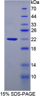 睪丸表達Amy1關聯(lián)蛋白(AAT1)重組蛋白,Recombinant Amy1 Associated Protein Expressed In Testis (AAT1)