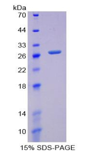 谷氨酸半胱氨酸連接酶(GCLM)重組蛋白,Recombinant Glutamate Cysteine Ligase, Modifier Subunit (GCLM)