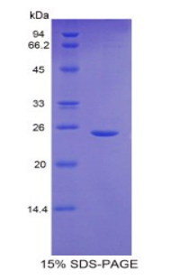 谷氨酸半胱氨酸连接酶催化亚基(GCLC)重组蛋白,Recombinant Glutamate Cysteine Ligase, Catalytic (GCLC)