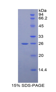 谷氨酸受体相互作用蛋白1(GRIP1)重组蛋白,Recombinant Glutamate Receptor Interacting Protein 1 (GRIP1)