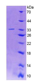 谷氨酸脱羧酶2(GAD2)重组蛋白,Recombinant Glutamate Decarboxylase 2 (GAD2)