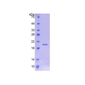 钙调蛋白样蛋白5(CALML5)重组蛋白