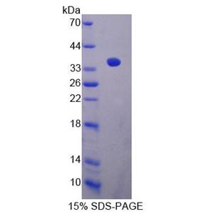 钙调磷酸酶结合蛋白1(CABIN1)重组蛋白,Recombinant Calcineurin Binding Protein 1 (CABIN1)