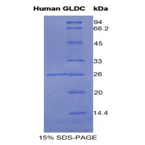 甘氨酸脱氢酶(GLDC)重组蛋白,Recombinant Glycine Dehydrogenase (GLDC)
