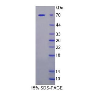 甘露糖苷酶α1A类成员1(MAN1A1)重组蛋白