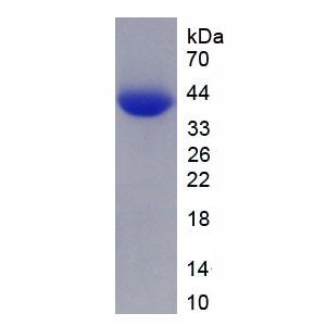 肝癌源性生长因子(HDGF)重组蛋白,Recombinant Hepatoma Derived Growth Factor (HDGF)