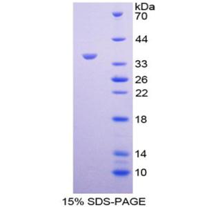 肝肠钙黏蛋白(CDH17)重组蛋白