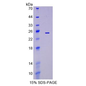 肝配蛋白A5(EFNA5)重组蛋白