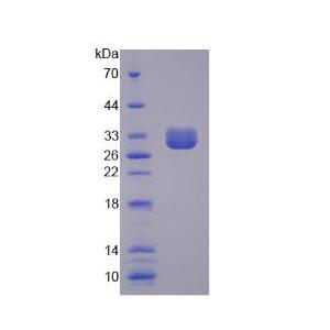 肝受体同源物1(LRH1)重组蛋白,Recombinant Liver Receptor Homolog 1 (LRH1)