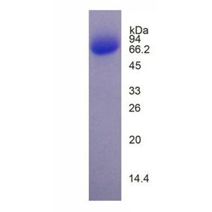 感光细胞特异性核受体(PNR)重组蛋白