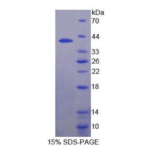 干扰素调节因子9(IRF9)重组蛋白,Recombinant Interferon Regulatory Factor 9 (IRF9)