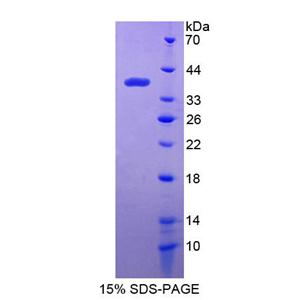 干扰素诱导蛋白35(IFI35)重组蛋白