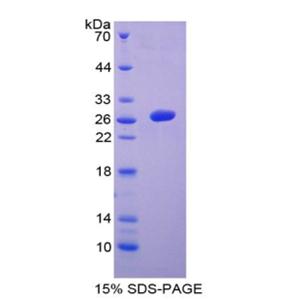 干细胞因子受体(SCFR)重组蛋白,Recombinant Stem Cell Factor Receptor (SCFR)