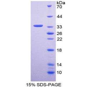 高迁移率族蛋白2样蛋白1(HMG2L1)重组蛋白,Recombinant High Mobility Group Protein 2 Like Protein 1 (HMG2L1)