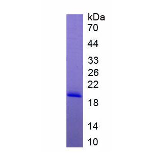 高迁移率族核小体结合域蛋白1(HMGN1)重组蛋白,Recombinant High Mobility Group Nucleosome Binding Domain Protein 1 (HMGN1)