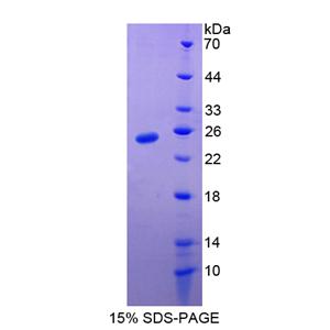 高迁移率族框蛋白2(HMGB2)重组蛋白