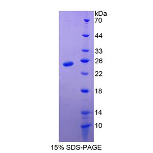 高迁移率族框蛋白2(HMGB2)重组蛋白,Recombinant High Mobility Group Box Protein 2 (HMGB2)