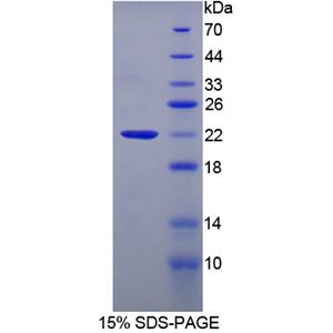 睪丸表達(dá)Amy1關(guān)聯(lián)蛋白(AAT1)重組蛋白