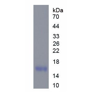 睾丸型脂肪酸结合蛋白(FABP9)重组蛋白,Recombinant Fatty Acid Binding Protein 9, Testis (FABP9)