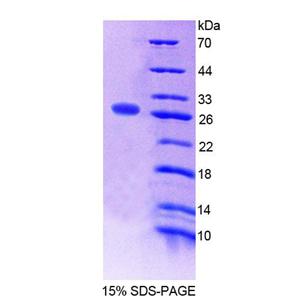 共济失调毛细血管扩张Rad3相关蛋白(ATR)重组蛋白