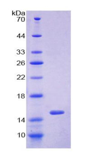 谷氧还蛋白(GLRX)重组蛋白,Recombinant Glutaredoxin (GLRX)